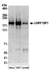 Detection of human UHRF1BP1 by western blot.