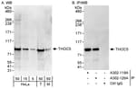 Detection of human and mouse THOC5 by western blot (h&amp;m) and immunoprecipitation (h).
