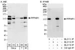 Detection of human and mouse PPP4R1 by western blot (h&amp;m) and immunoprecipitation (h).
