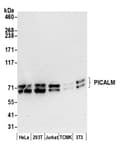 Detection of human and mouse PICALM by western blot.