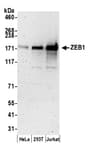 Detection of human ZEB1 by western blot.