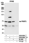 Detection of human PRMT5 by western blot of immunoprecipitates.