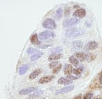 Detection of human REA by immunohistochemistry.