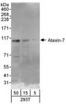 Detection of human Ataxin-7 by western blot.