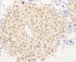 Detection of mouse FOXO3a by immunohistochemistry.