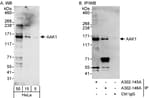 Detection of human AAK1 by western blot and immunoprecipitation.