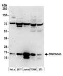Detection of human and mouse Stathmin by western blot.