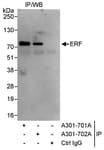 Detection of human ERF by western blot of immunoprecipitates.