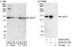 Detection of human and mouse Vps15 by western blot (h&amp;m) and immunoprecipitation (h).