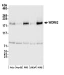 Detection of human WDR62 by western blot.