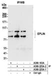 Detection of human EPLIN by western blot of immunoprecipitates.