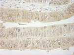 Detection of human SYK by immunohistochemistry.