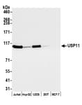 Detection of human USP11 by western blot.