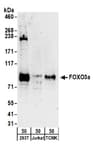 Detection of human and mouse FOXO3a by western blot.