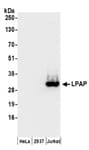 Detection of human LPAP by western blot.