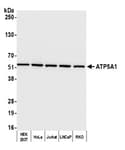 Detection of human ATP5A1 by western blot.