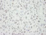Detection of mouse MCM5 by immunohistochemistry.