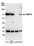 Detection of human and mouse FKBP10 by western blot.