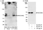 Detection of human and mouse NCOA62 by western blot and immunoprecipitation.