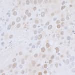 Detection of mouse CTR9 by immunohistochemistry.