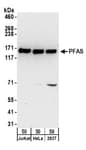 Detection of human PFAS by western blot.