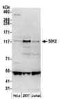 Detection of human SIK2 by western blot.