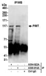Detection of human PIMT by western blot of immunoprecipitates.