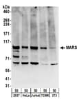 Detection of human and mouse MARS by western blot.