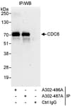 Detection of human CDC6 by western blot of immunoprecipitates.