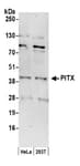 Detection of human PITX by western blot.