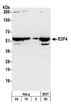 Detection of human E2F4 by western blot.
