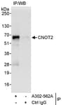 Detection of human CNOT2 by western blot of immunoprecipitates.