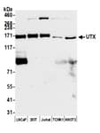 Detection of human and mouse UTX by western blot.