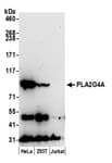 Detection of human PLA2G4A by western blot.