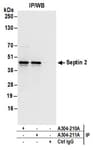 Detection of human Septin 2 by western blot of immunoprecipitates.