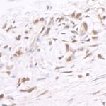 Detection of human BRD2 by immunohistochemistry.