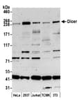 Detection of human and mouse Dicer by western blot.