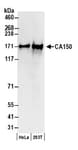 Detection of human CA150 by western blot.