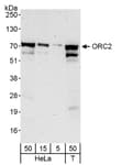 Detection of human ORC2 by western blot.