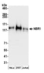 Detection of human NBR1 by western blot.