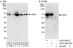 Detection of human and mouse PSP1 by western blot (h and m) and immunoprecipitation (h).