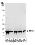 Detection of human and mouse RPS11 by western blot.