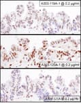 Detection of human NF90 and NF110 by immunohistochemistry.