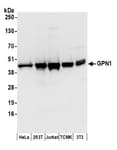 Detection of human and mouse GPN1 by western blot.