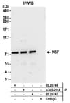 Detection of human NSF by western blot of immunoprecipitates.