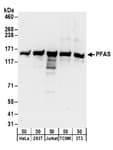 Detection of human and mouse PFAS by western blot.