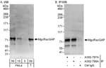Detection of human MgcRacGAP by western blot and immunoprecipitation.