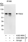 Detection of human Hakai by western blot of immunoprecipitates.