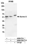 Detection of human Aurora A by western blot of immunoprecipitates.