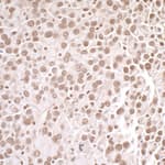 Detection of mouse PRMT1 by immunohistochemistry.